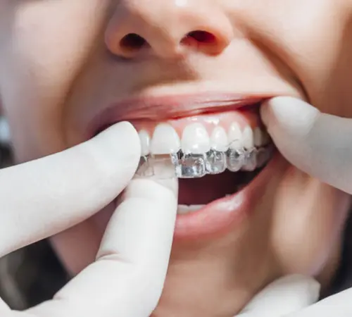 Obstrüktif Uyku Apne Sendromu Nedir? Belirtiler, Riskler ve Tedavi Yöntemleri